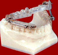 Modell eines Anti-Schnarch-Gerätes